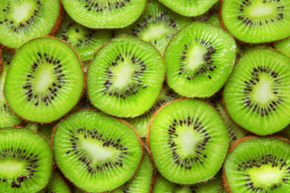 kiwi w ciąży